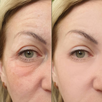 FlawlessDream Pillow - Das angenehmste Anti-Aging-Kissen Deutschlands