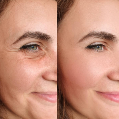 FlawlessDream Pillow - Das angenehmste Anti-Aging-Kissen Deutschlands